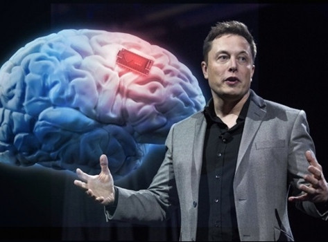 Elon Musk’s Neuralink Gets $27 Million to Build Brain Computers