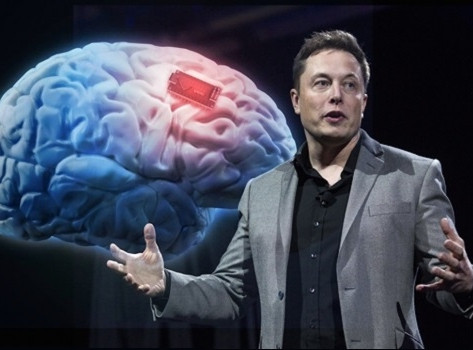 neuralink elon musk computers brain million gets build